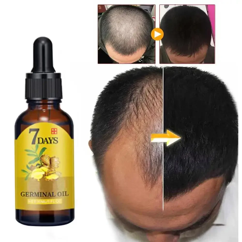 Ingrown Hair Serum - Hair Growth Ginger Fast Growing Hair