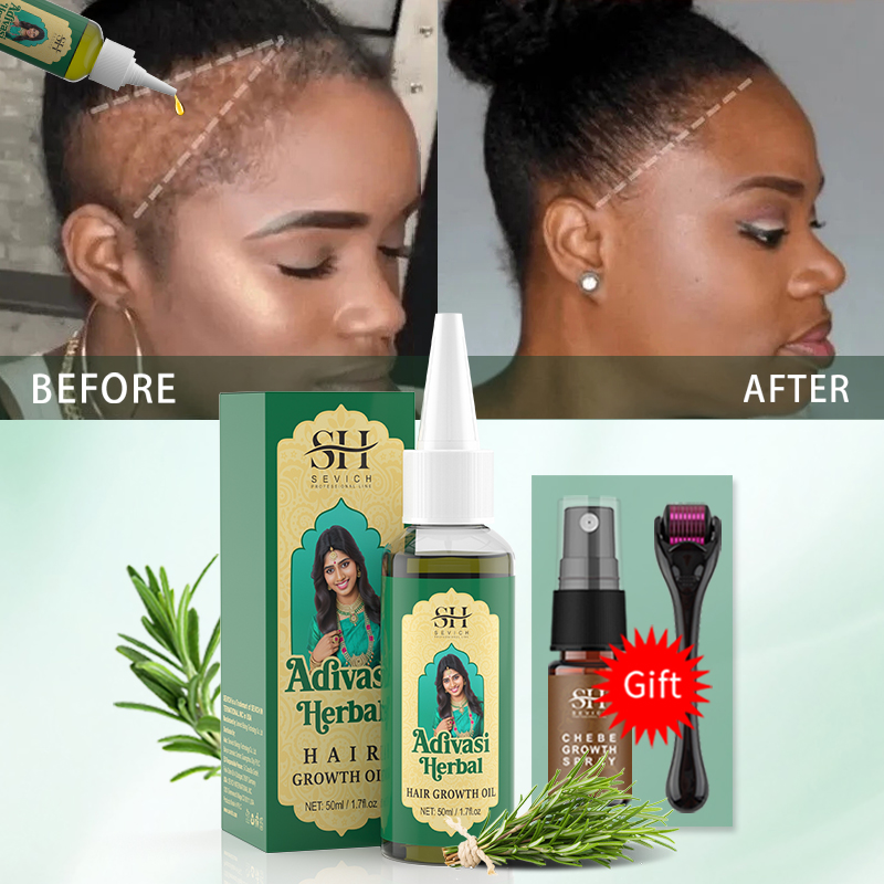 Ayurvedic Hair Growth Oil Indi - огляд і ціна Ingrown Hair Serum