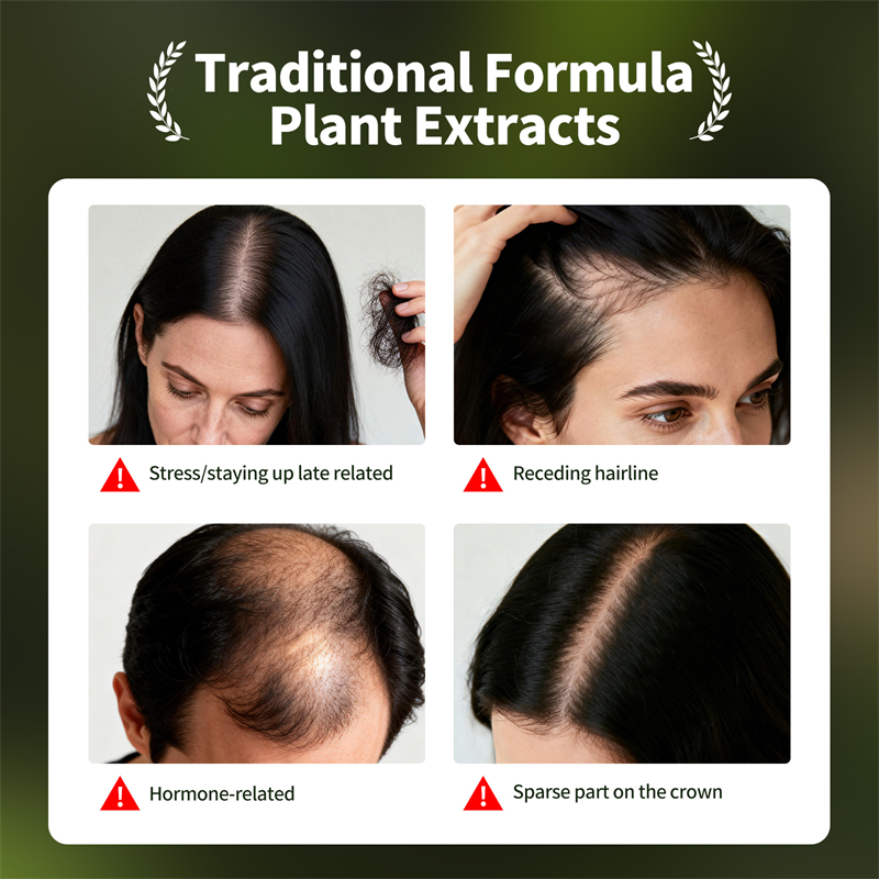 Natural Hair Growth Set Usman  - огляд і ціна Ingrown Hair Serum