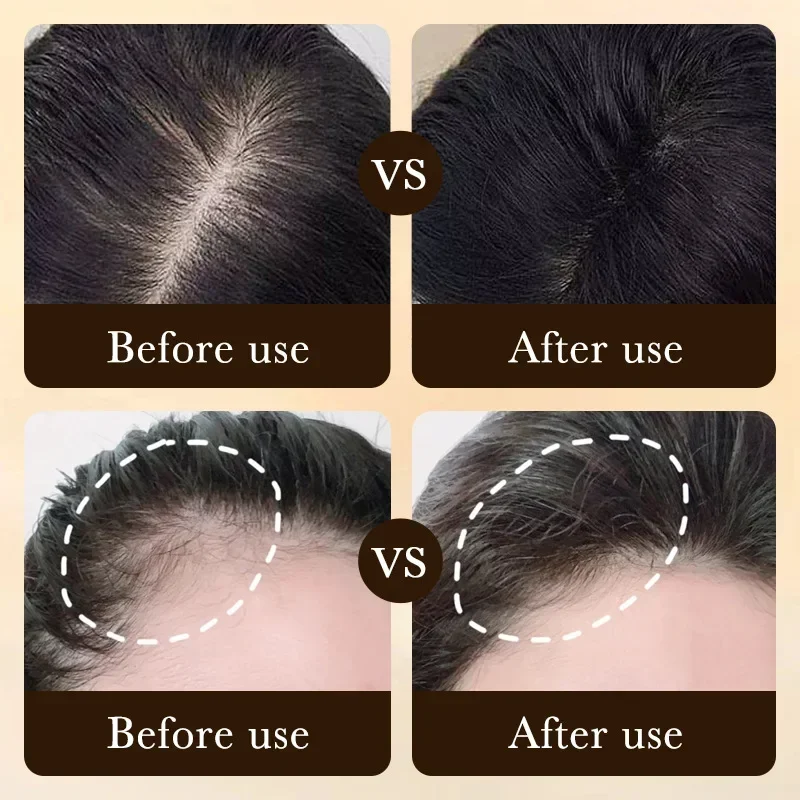 Biotin Fast Hair Growth Oil Pr - огляд і ціна Ingrown Hair Serum