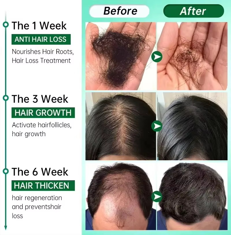 Hair Growth Serum 7 Days Fast  - огляд і ціна Ingrown Hair Serum