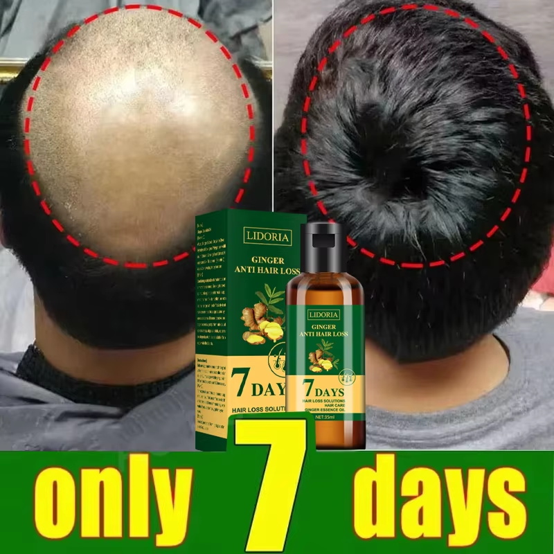 Hair Growth Serum 7 Days Fast  - огляд і ціна Ingrown Hair Serum