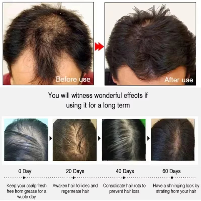 Hair Growth Serum 7 Days Fast  - огляд і ціна Ingrown Hair Serum