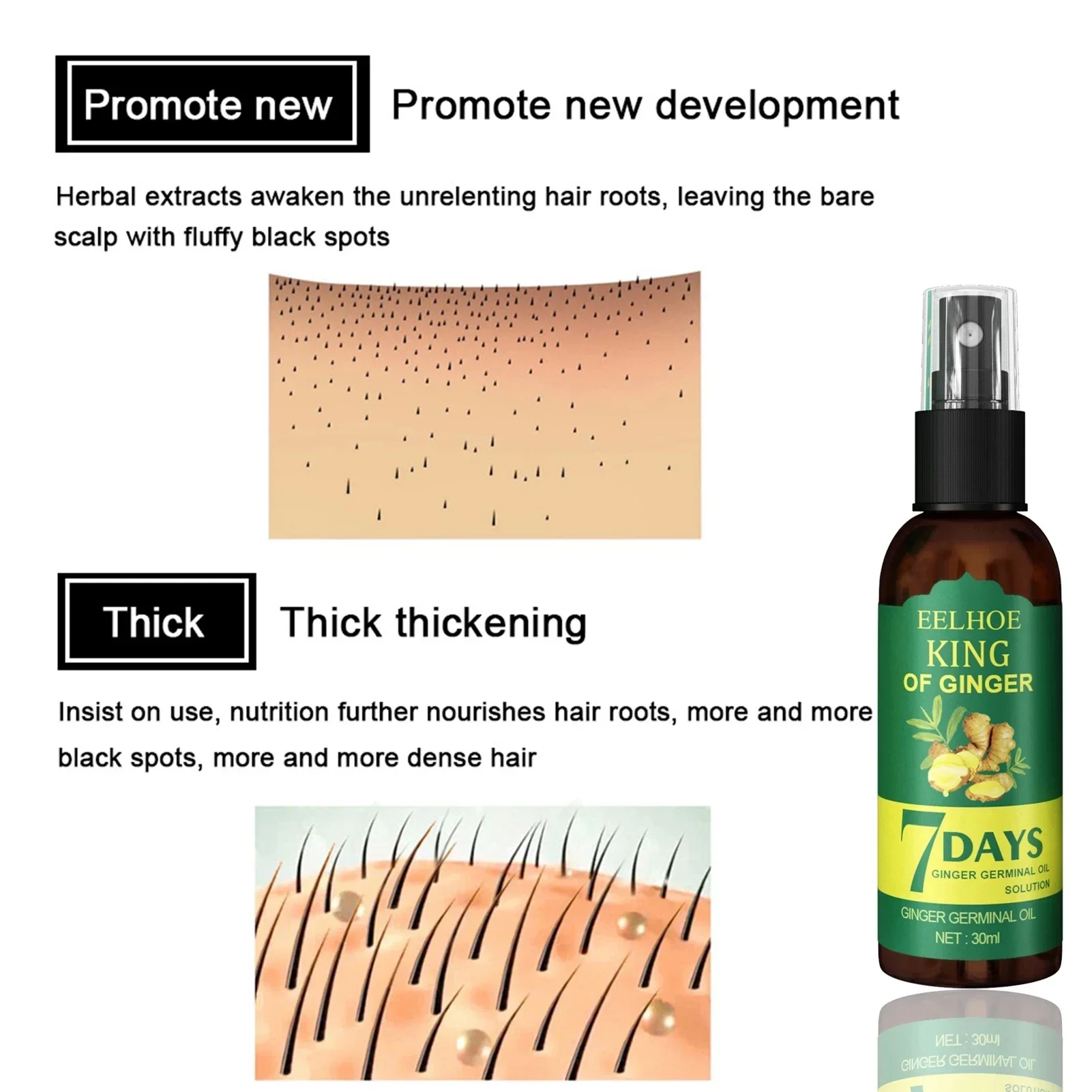 2024 Ginger Hair Growth Serum  - огляд і ціна Ingrown Hair Serum