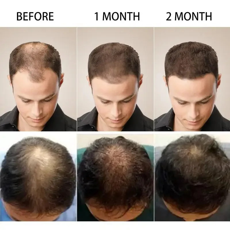 Hair Growth Ginger Fast Growin - огляд і ціна Ingrown Hair Serum
